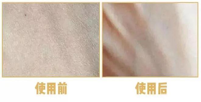 不涂身体乳身体会有多大差别？开元棋牌试玩坚持涂 vs(图1)